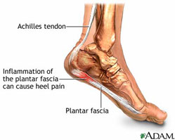 Plantar-3