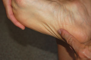 Plantar Stretch-2