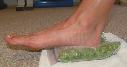 Frozen Peas-Plantar Fasciitis Ice Therapy