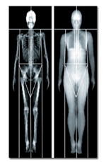 DEXA Photo-2