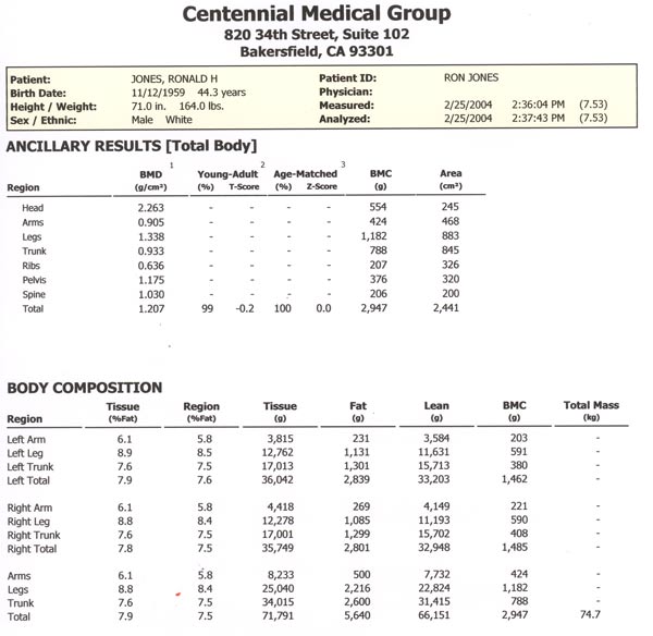 Ron Jones' DEXA Body Scan "Regional BMD & Body Fat" Report