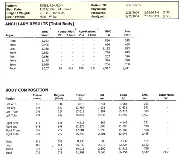 RJ-DEXA Body Fat